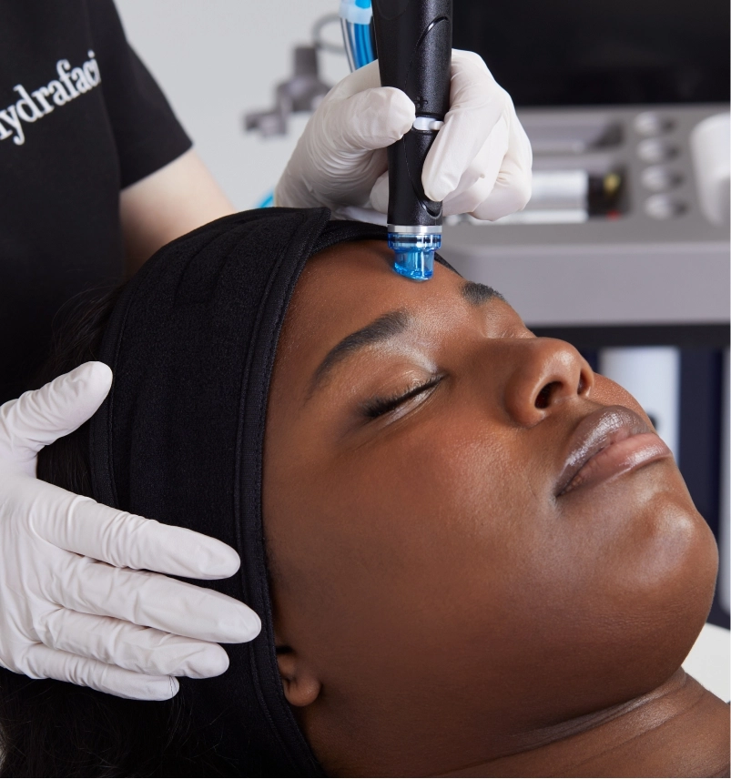 Aesthetician performing a HydraFacial treatment on a client’s forehead using a specialized device for deep cleansing and skin rejuvenation.